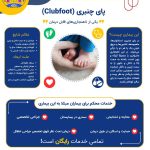 معرفی بیماری‌های تحت پوشش موسسه خیریه محکم؛ پای چنبری (Clubfoot)